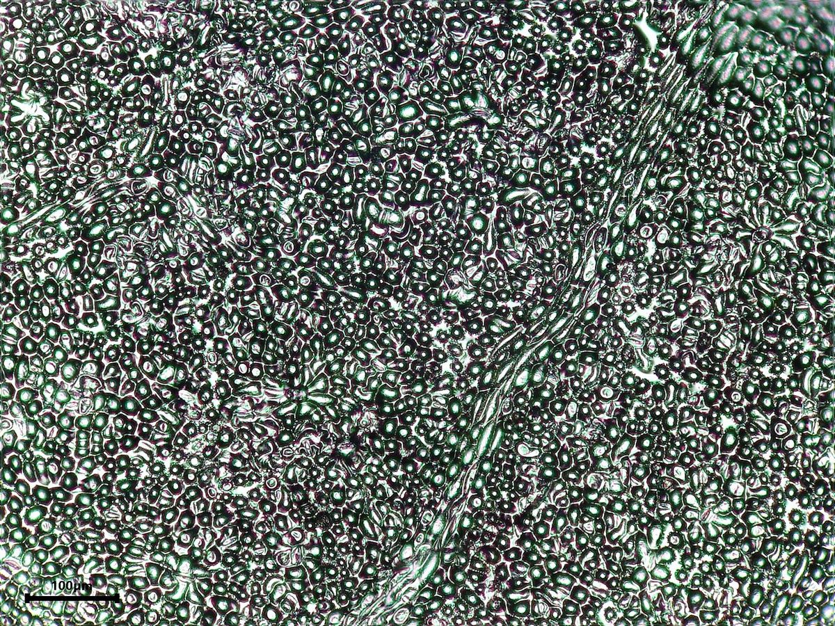 Imagen de microscopio con tejido vegetal ampliado y una escala micrométrica.